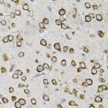 Immunohistochemistry - Anti-CEP164 Antibody (A16384) - Antibodies.com