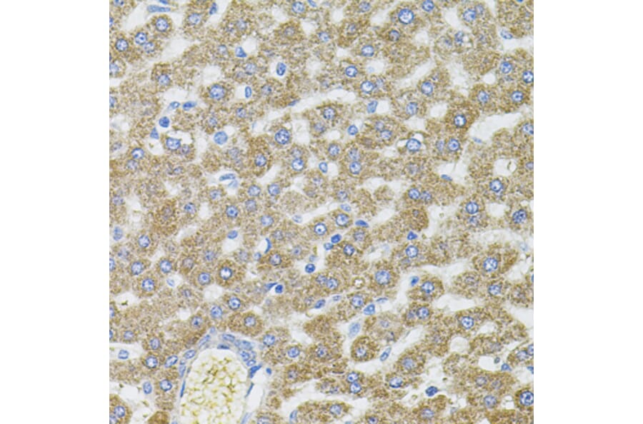Immunohistochemistry - Anti-CEP164 Antibody (A16384) - Antibodies.com