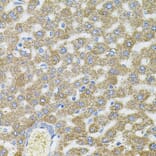 Immunohistochemistry - Anti-CEP164 Antibody (A16384) - Antibodies.com