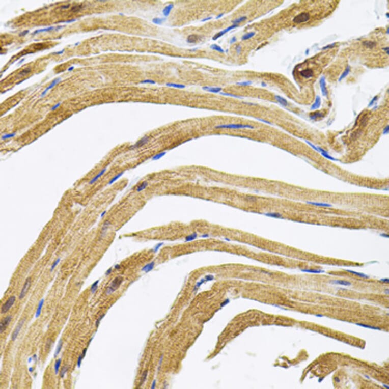 Immunohistochemistry - Anti-CEP164 Antibody (A16384) - Antibodies.com