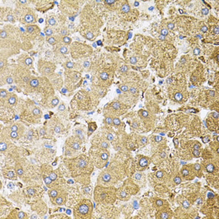 Immunohistochemistry - Anti-CEP164 Antibody (A16384) - Antibodies.com