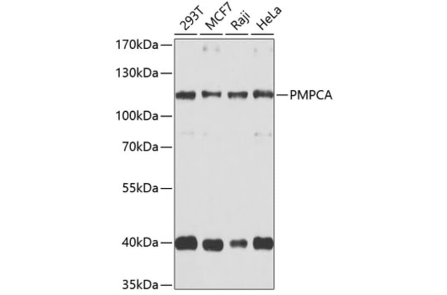 Western Blot - Anti-PMPCA / INPP5E Antibody (A16385) - Antibodies.com