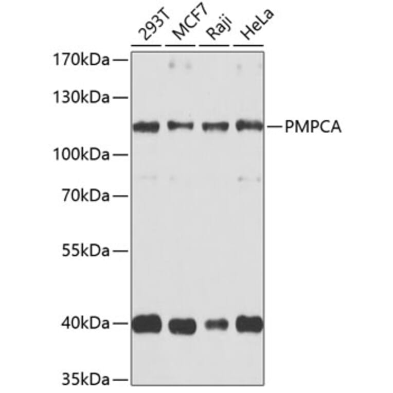 Western Blot - Anti-PMPCA / INPP5E Antibody (A16385) - Antibodies.com