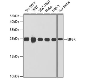 Western Blot - Anti-eIF3K Antibody (A16386) - Antibodies.com