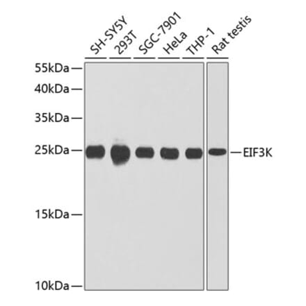 Western Blot - Anti-eIF3K Antibody (A16386) - Antibodies.com