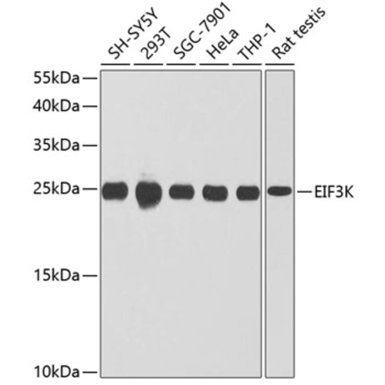 Western Blot - Anti-eIF3K Antibody (A16386) - Antibodies.com