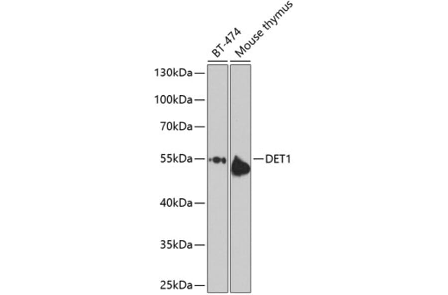 Western Blot - Anti-DET1 Antibody (A16387) - Antibodies.com
