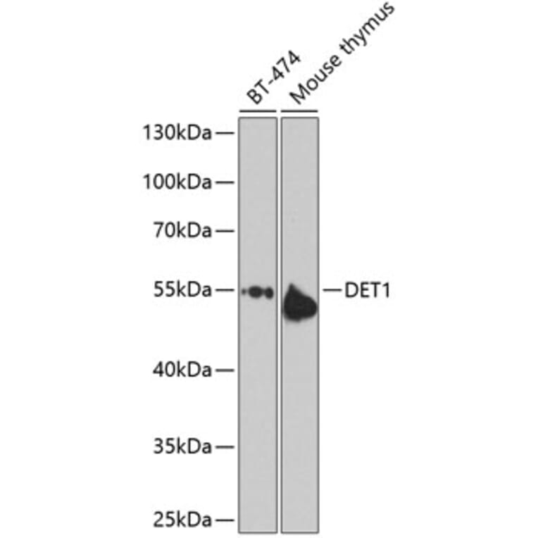 Western Blot - Anti-DET1 Antibody (A16387) - Antibodies.com