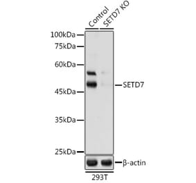 Western Blot - Anti-SET7 Antibody (A16389) - Antibodies.com