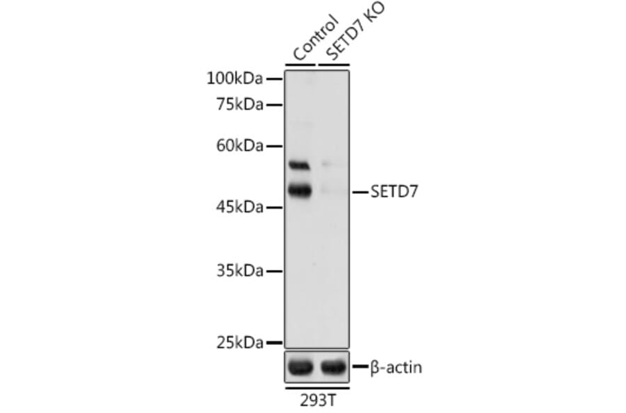 Western Blot - Anti-SET7 Antibody (A16389) - Antibodies.com