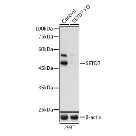 Western Blot - Anti-SET7 Antibody (A16389) - Antibodies.com