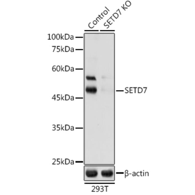 Western Blot - Anti-SET7 Antibody (A16389) - Antibodies.com