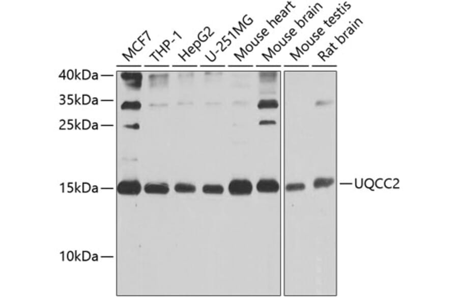 Western Blot - Anti-MNF1 Antibody (A16390) - Antibodies.com