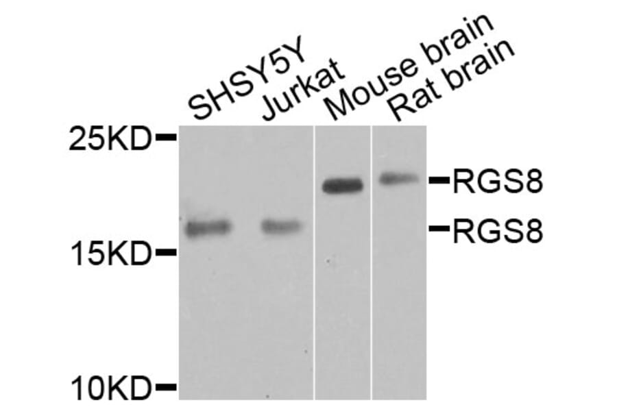 Western Blot - Anti-RGS8 Antibody (A9987) - Antibodies.com
