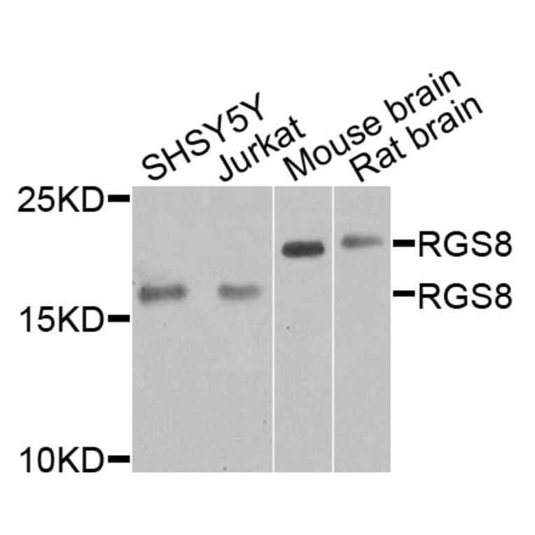 Western Blot - Anti-RGS8 Antibody (A9987) - Antibodies.com