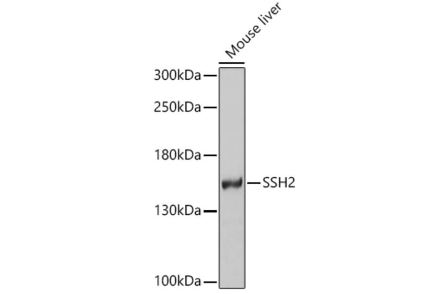 Western Blot - Anti-SSH2 Antibody (A16392) - Antibodies.com