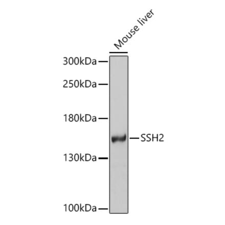 Western Blot - Anti-SSH2 Antibody (A16392) - Antibodies.com