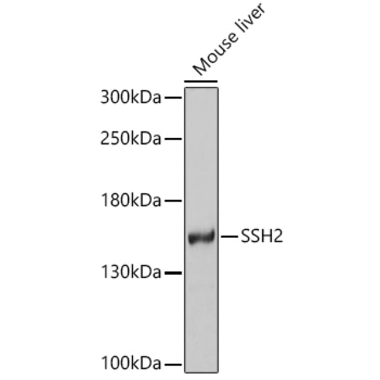 Western Blot - Anti-SSH2 Antibody (A16392) - Antibodies.com
