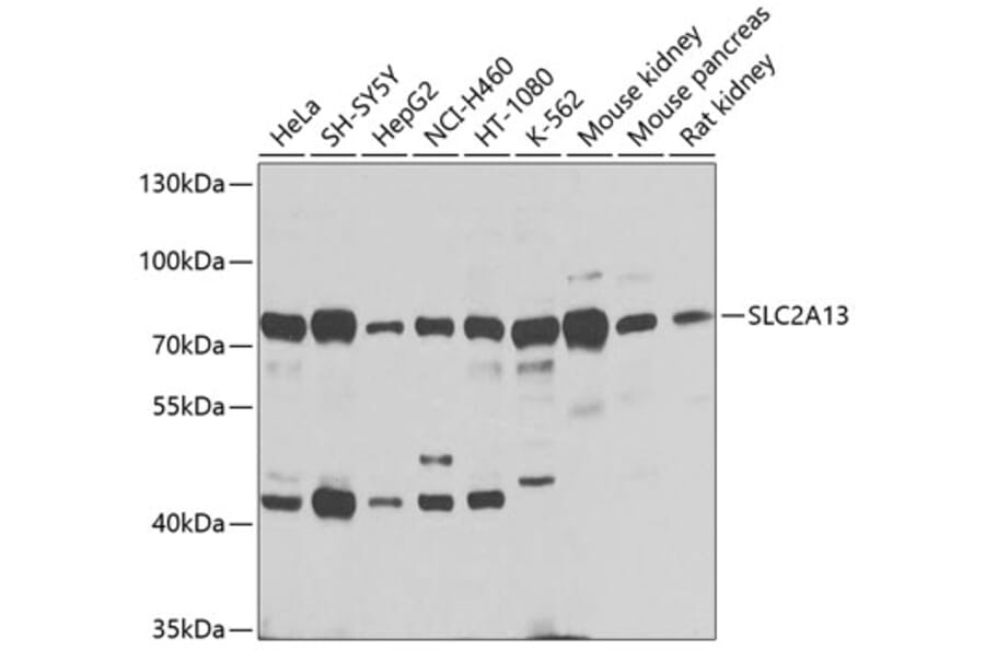 Western Blot - Anti-SLC2A13 Antibody (A16393) - Antibodies.com