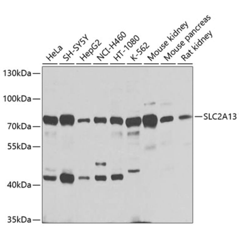 Western Blot - Anti-SLC2A13 Antibody (A16393) - Antibodies.com