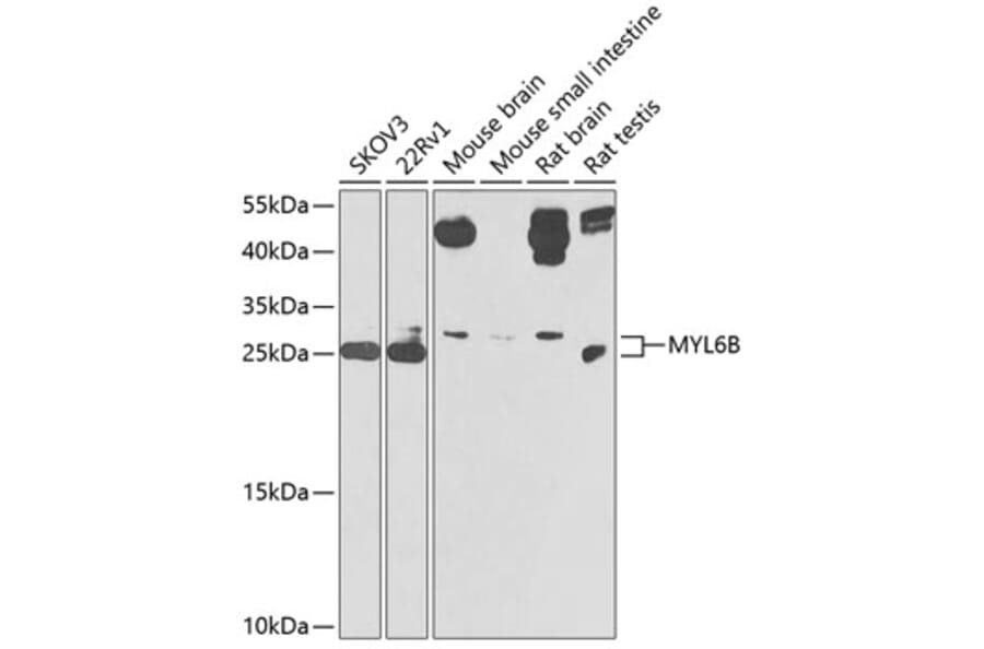 Western Blot - Anti-MYL6B Antibody (A9996) - Antibodies.com