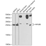 Western Blot - Anti-MYL6B Antibody (A9996) - Antibodies.com