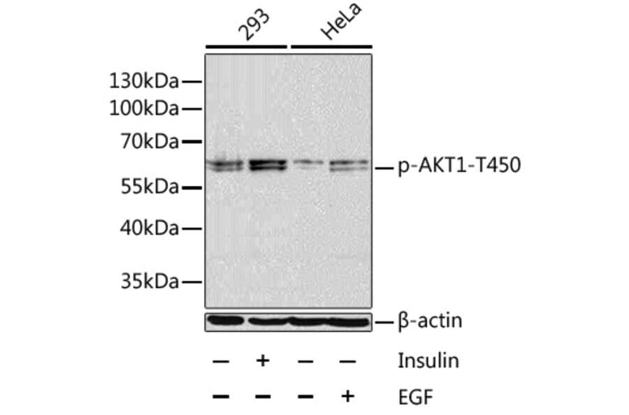 Western Blot - Anti-AKT1 (phospho Thr450) Antibody (A16395) - Antibodies.com