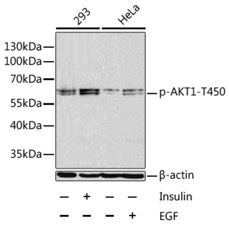 Western Blot - Anti-AKT1 (phospho Thr450) Antibody (A16395) - Antibodies.com