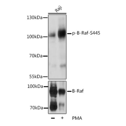 Western Blot - Anti-BRAF (phospho Ser445) Antibody (A16398) - Antibodies.com