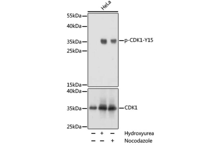 Western Blot - Anti-CDK1 (phospho Tyr15) Antibody (A16400) - Antibodies.com