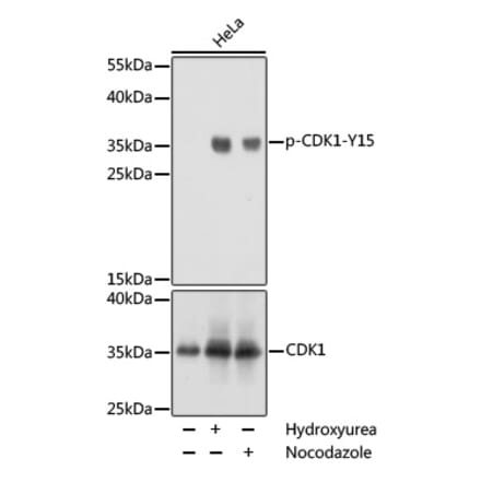 Western Blot - Anti-CDK1 (phospho Tyr15) Antibody (A16400) - Antibodies.com