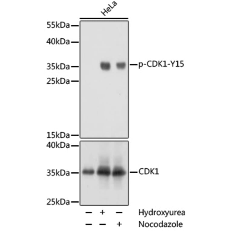 Western Blot - Anti-CDK1 (phospho Tyr15) Antibody (A16400) - Antibodies.com