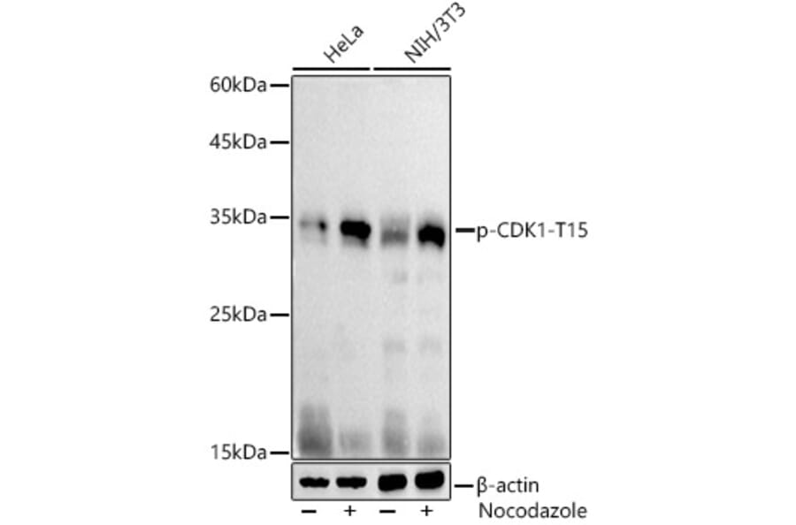 Western Blot - Anti-CDK1 (phospho Tyr15) Antibody (A16400) - Antibodies.com