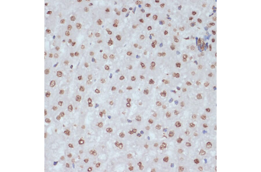 Immunohistochemistry - Anti-CDK1 (phospho Tyr15) Antibody (A16400) - Antibodies.com
