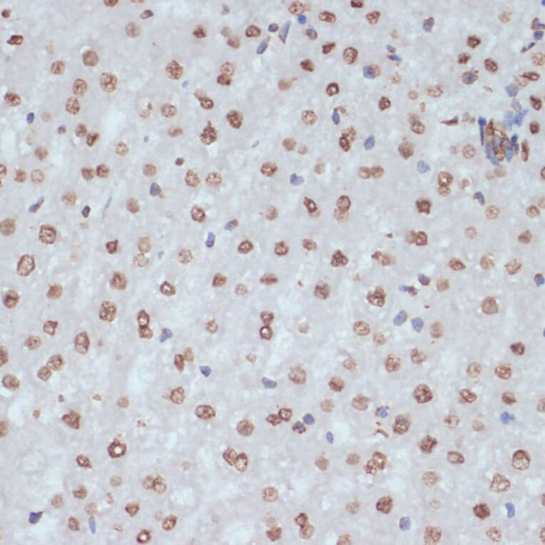 Immunohistochemistry - Anti-CDK1 (phospho Tyr15) Antibody (A16400) - Antibodies.com