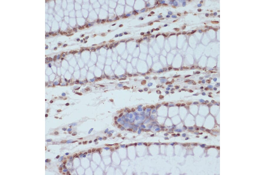 Immunohistochemistry - Anti-CDK1 (phospho Tyr15) Antibody (A16400) - Antibodies.com