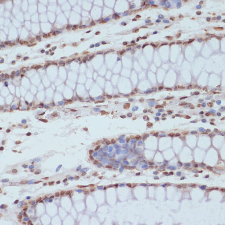 Immunohistochemistry - Anti-CDK1 (phospho Tyr15) Antibody (A16400) - Antibodies.com