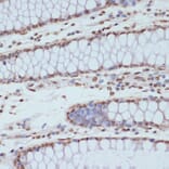 Immunohistochemistry - Anti-CDK1 (phospho Tyr15) Antibody (A16400) - Antibodies.com