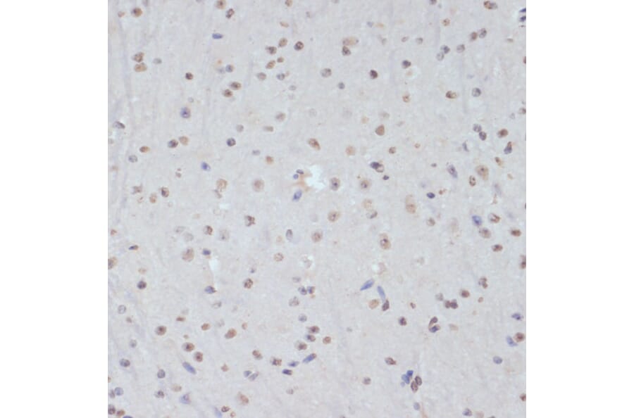 Immunohistochemistry - Anti-CDK1 (phospho Tyr15) Antibody (A16400) - Antibodies.com