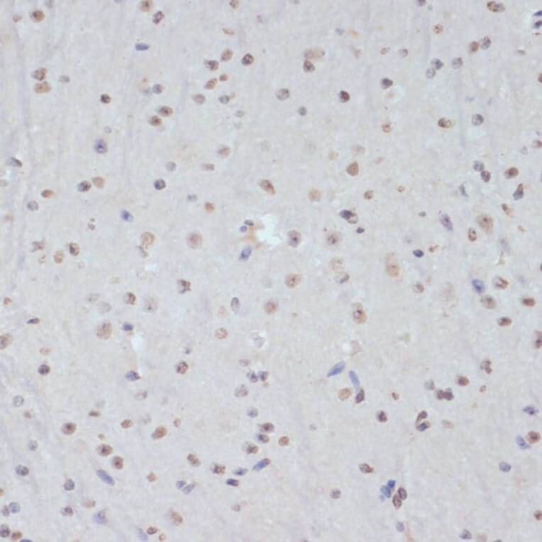 Immunohistochemistry - Anti-CDK1 (phospho Tyr15) Antibody (A16400) - Antibodies.com