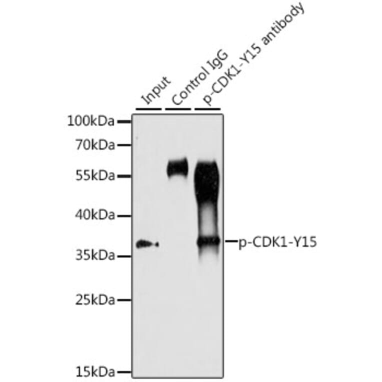 Western Blot - Anti-CDK1 (phospho Tyr15) Antibody (A16400) - Antibodies.com