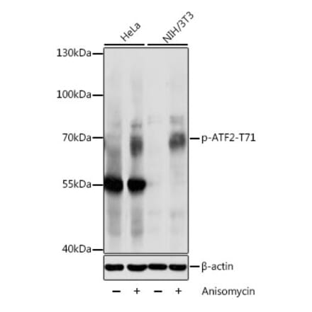 Western Blot - Anti-ATF2 (phospho Thr71) Antibody (A16401) - Antibodies.com