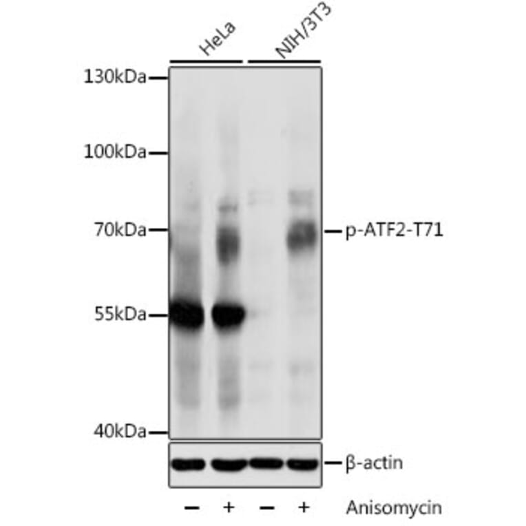 Western Blot - Anti-ATF2 (phospho Thr71) Antibody (A16401) - Antibodies.com