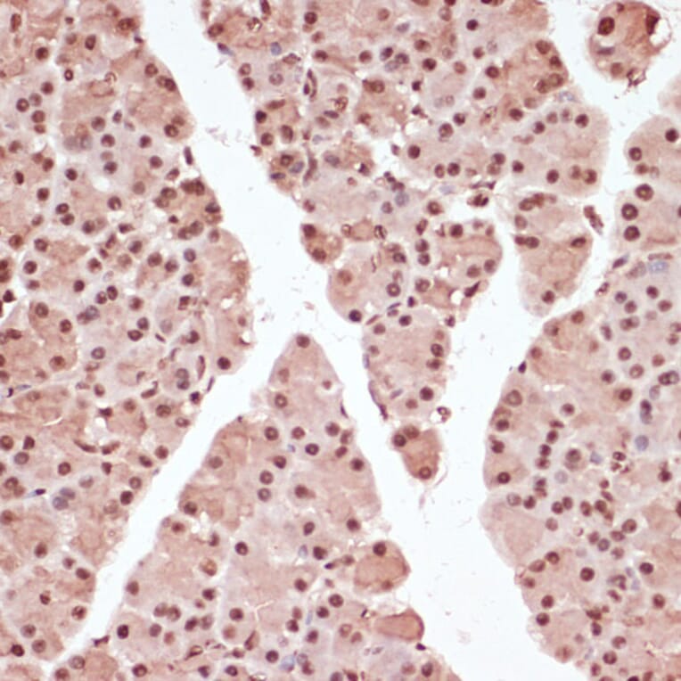 Immunohistochemistry - Anti-ATF2 (phospho Thr71) Antibody (A16401) - Antibodies.com