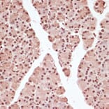 Immunohistochemistry - Anti-ATF2 (phospho Thr71) Antibody (A16401) - Antibodies.com