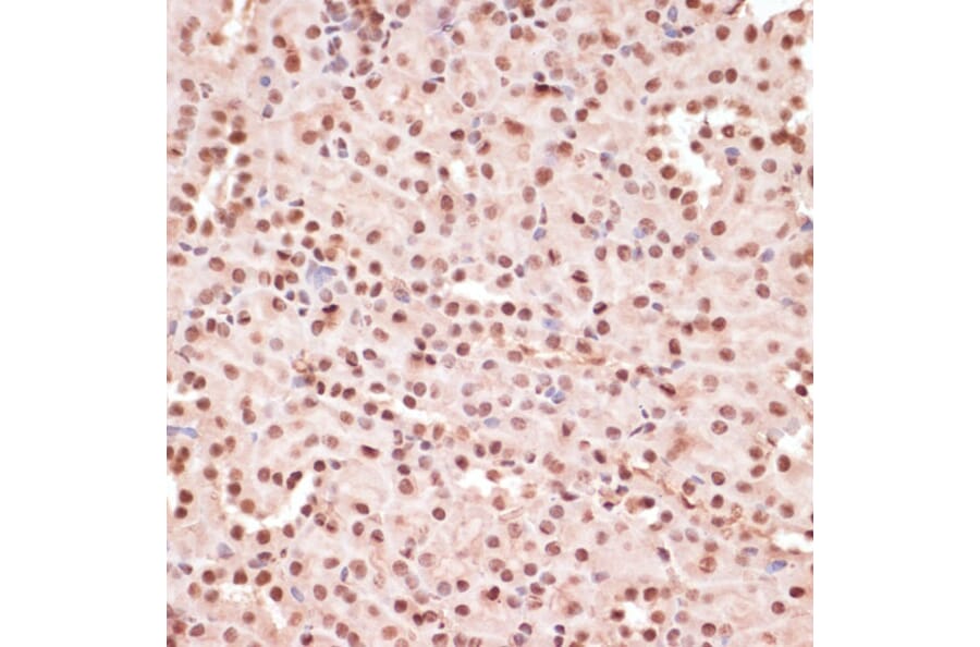 Immunohistochemistry - Anti-ATF2 (phospho Thr71) Antibody (A16401) - Antibodies.com