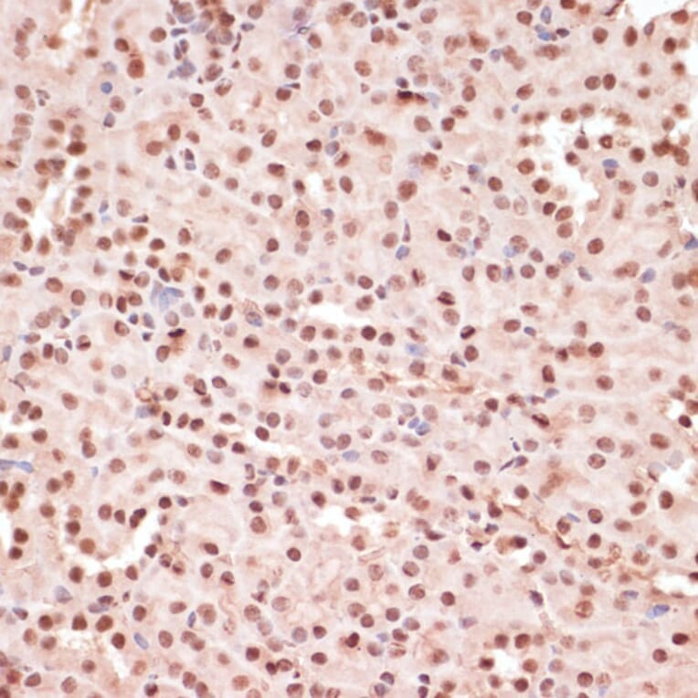 Immunohistochemistry - Anti-ATF2 (phospho Thr71) Antibody (A16401) - Antibodies.com