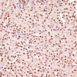 Immunohistochemistry - Anti-ATF2 (phospho Thr71) Antibody (A16401) - Antibodies.com