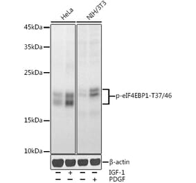 Western Blot - Anti-eIF4EBP1 (phospho Thr37 + Thr46) Antibody (A16402) - Antibodies.com