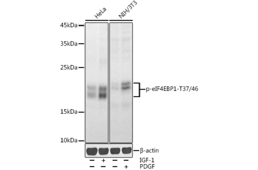Western Blot - Anti-eIF4EBP1 (phospho Thr37 + Thr46) Antibody (A16402) - Antibodies.com